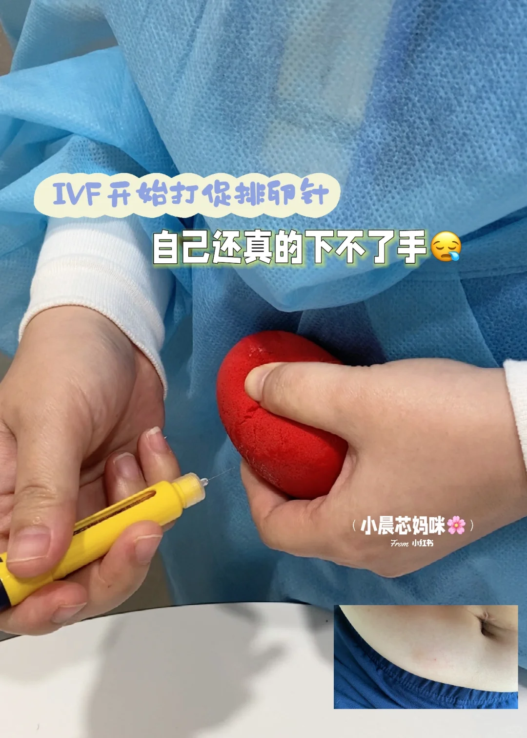我的IVF过程记录和分享（2）💉,国内助孕是真的吗还是假的，国内供卵做几代试管